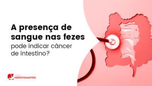 A Presen A De Sangue Nas Fezes Pode Indicar C Ncer De Intestino