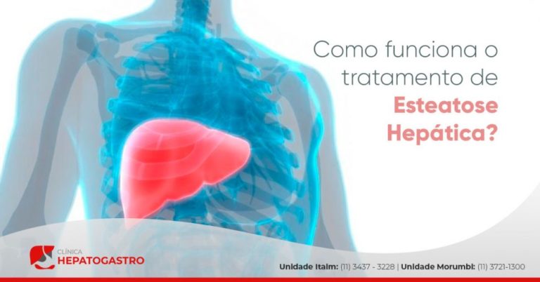 Como Funciona O Tratamento De Esteatose Hepática? - Clínica Hepatogastro