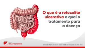 O Que é A Retocolite Ulcerativa E Qual O Tratamento Para A Doença ...