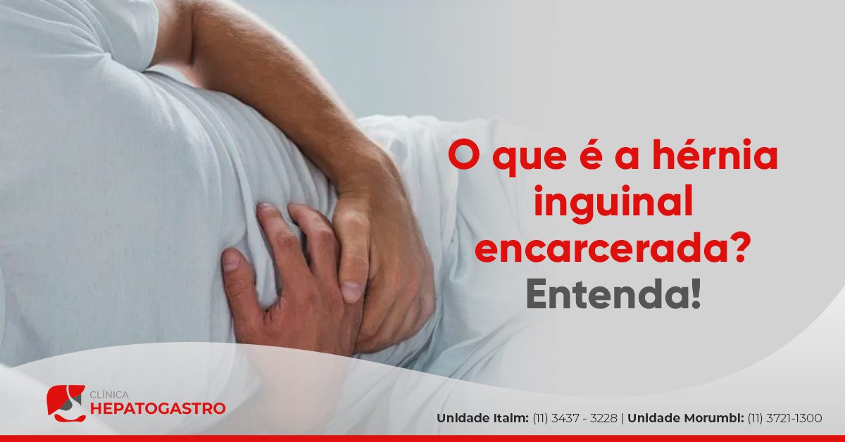 O Que A H Rnia Inguinal Encarcerada Entenda Cl Nica Hepatogastro