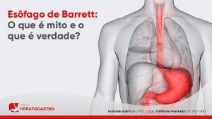 Esôfago De Barrett: O Que é Mito E O Que é Verdade? - Clínica Hepatogastro