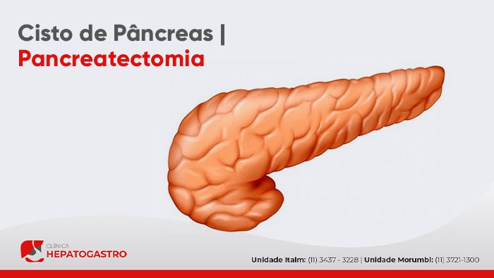 Cisto De Pancreas Pancreatectomia Hepatogastro Bg