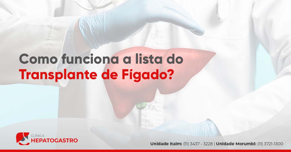 Como Funciona A Lista Do Transplante De Fígado Clínica Hepatogastro 9999