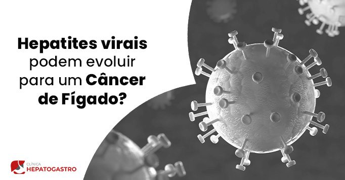Hepatites Virais Podem Evoluir Para Um Cancer De Figado Hepatogastro Bg