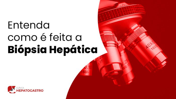 Entenda Como E Feita A Biopsia Hepatica Clinica Hepatogastro Bg