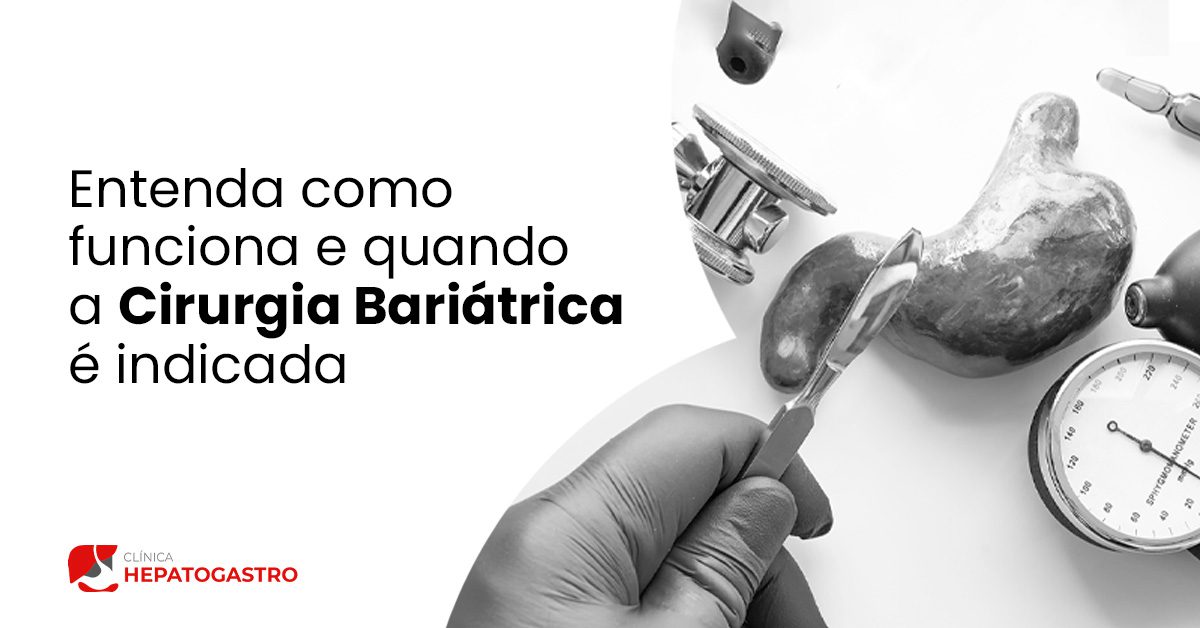 Entenda Como Funciona E Quando A Cirurgia Bariátrica é Indicada ...