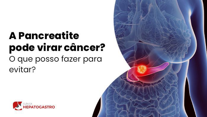 A Pancreatite Pode Virar Cancer O Que Posso Fazer Para Evitar Hepatogastro Bg
