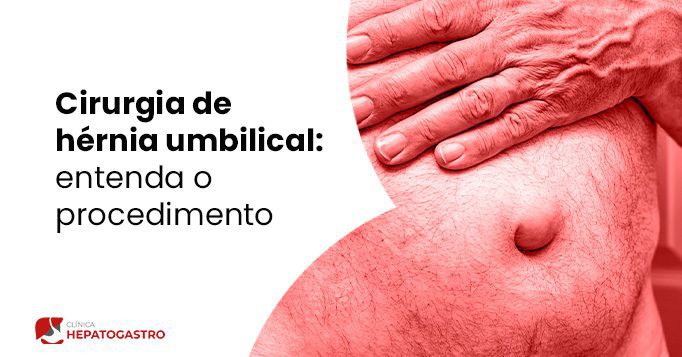 Cirurgia De Hérnia Umbilical: Entenda O Procedimento - Clínica Hepatogastro