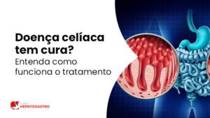 Doenca Celiaca Tem Cura Entenda Como Funciona O Tratamento Bg