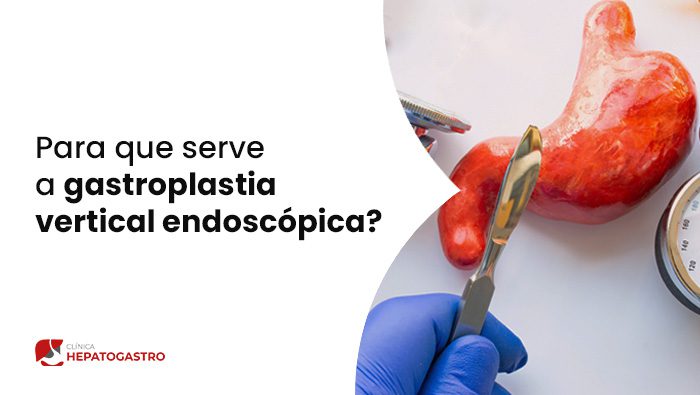 Para Que Serve A Gastroplastia Vertical Endoscopica Hepatogastro Bg