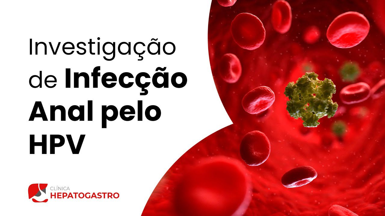 Investigação De Infecção Anal Pelo HPV - Clínica Hepatogastro