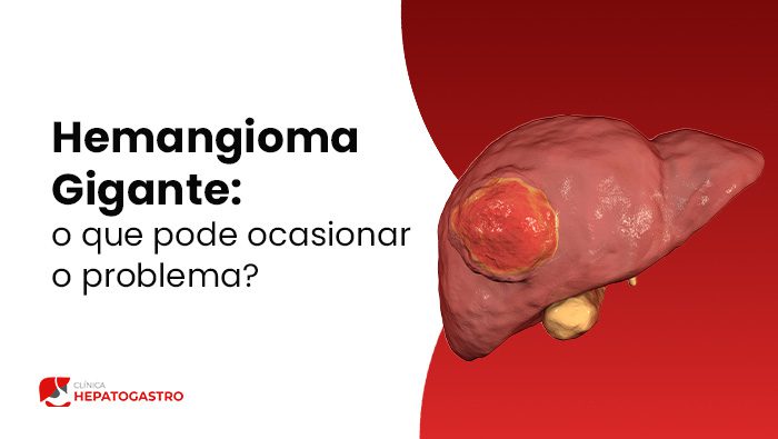 a imagem ilustra um hemangioma hepático gigante 