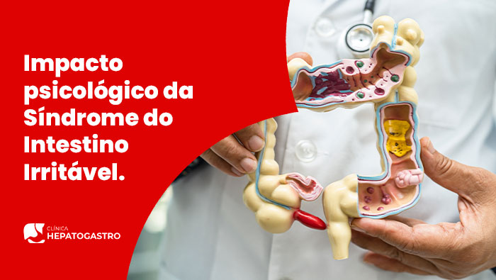 Hepatogastro.com .Brimpacto Psicologico Da Sindrome Do Intestino Irritavel Blog