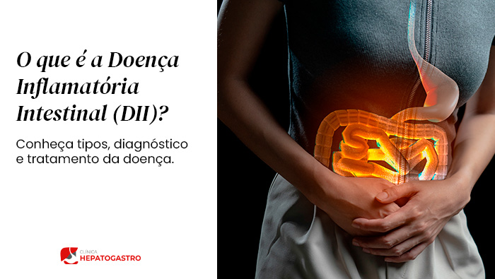 O Que E A Doenca Inflamatoria Intestinal Dii Conheca Tipos Diagnostico E Tratamento Da Doenca Blog