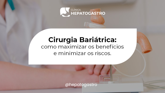 Modelo Anatômico De Estômago Com Uma Banda Gástrica, Usado Para Explicar Cirurgia Bariátrica, Sobre Uma Base De Suporte, Com Mãos Desfocadas Ao Fundo.