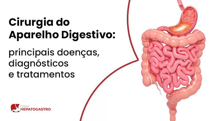 Cirurgia Do Aparelho Digestivo Hepatogastro Blog