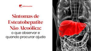 Sintomas De Esteatohepatite Não Alcoólica: O Que Observar E Quando ...