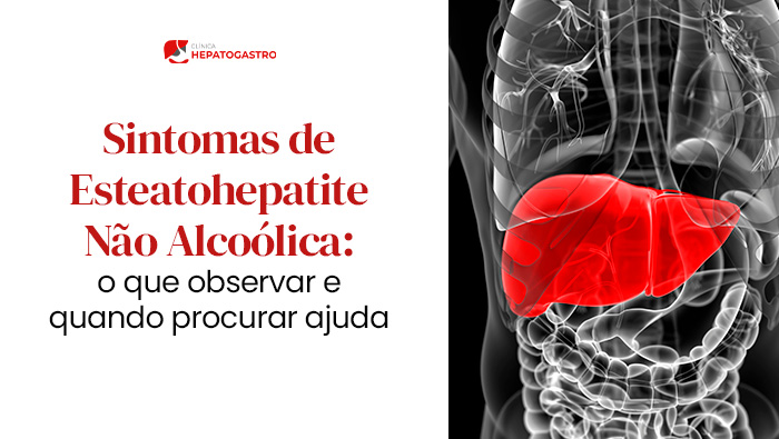 Imagem De Um Torso Humano Em Raio-X, Com O Fígado Destacado Em Vermelho, Representando Foco Em Problemas Hepáticos Ou Condições Relacionadas Ao Fígado.