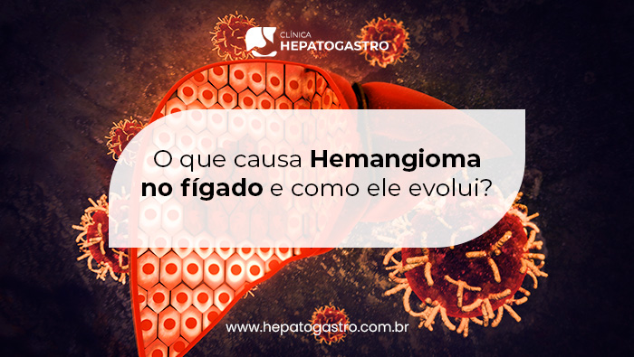 Ilustração de um fígado com destaque celular em tom avermelhado, cercado por vírus, representando uma condição hepática como hemangioma.