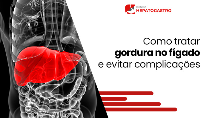 Ilustração do corpo humano com destaque em vermelho para o fígado, evidenciando sua localização no abdômen.
