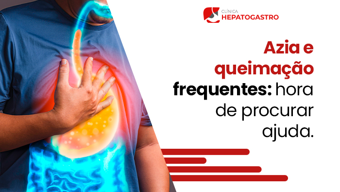 Pessoa Com Camiseta Azul Segura O Peito, Com Ilustração Digital Do Estômago E Esôfago Em Refluxo, Representando Azia E Queimação.