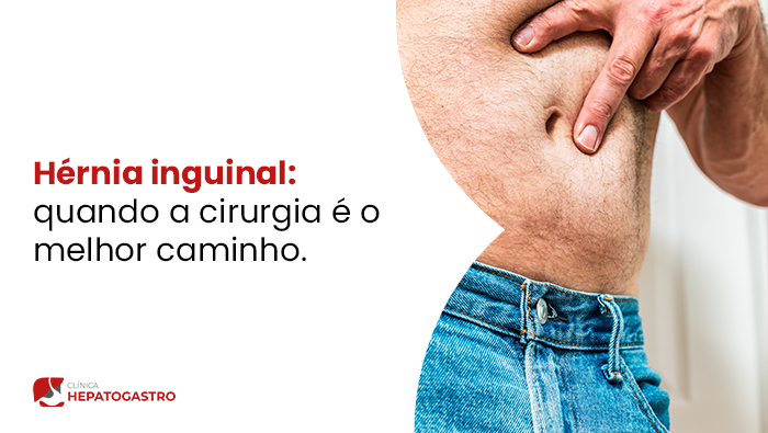 Homem Aponta Para A Região Do Umbigo, Mostrando Abdômen Exposto Com Sinal De Alteração Hepática Associado À Esteatose.