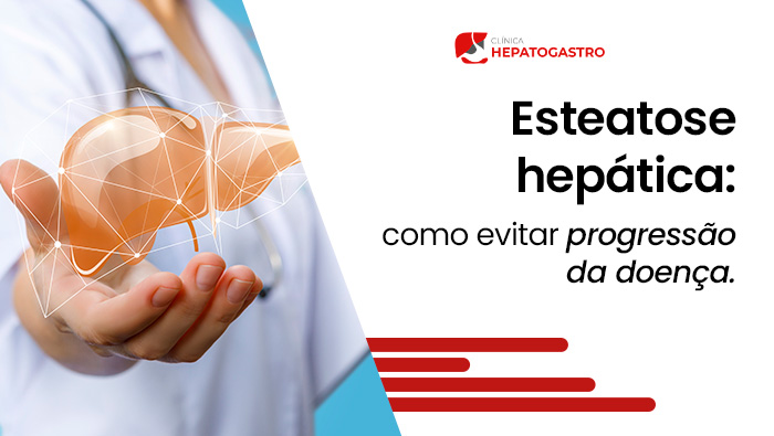 Esteatose Hepática: Como Evitar A Progressão Da Doença 1 Profissional De Saúde Segura Representação Digital De Fígado Humano Na Mão, Simbolizando Cuidado E Avaliação Da Saúde Hepática.