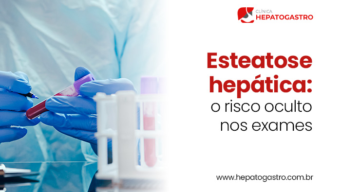 Esteatose Hepática: O Risco Oculto Nos Exames 1 Profissional De Saúde Com Luvas Manipula Tubos De Ensaio Com Sangue Em Bancada De Laboratório.