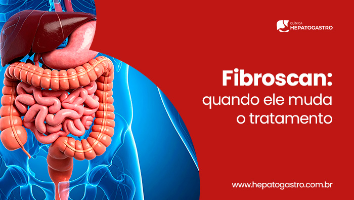 Fibroscan: Quando Ele Muda O Tratamento 1 Ilustração Do Sistema Digestivo Humano Com Fígado, Estômago E Intestinos Destacados Em Visão Frontal Do Corpo.