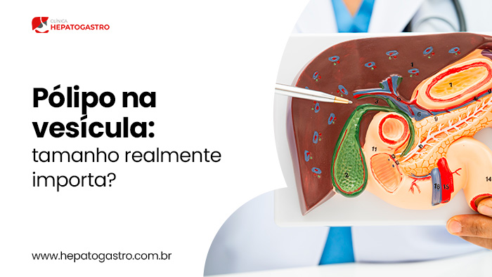 Pólipo Na Vesícula: Tamanho Realmente Importa? 1 Profissional De Saúde Aponta Para Modelo Anatômico Do Fígado, Vesícula E Pâncreas, Explicando Estruturas Do Sistema Digestivo.
