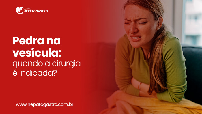 Pedra Na Vesícula: Quando A Cirurgia É Indicada? 1 Mulher Segurando O Abdômen Com Expressão De Dor, Representando Desconforto Causado Por Pedra Na Vesícula.
