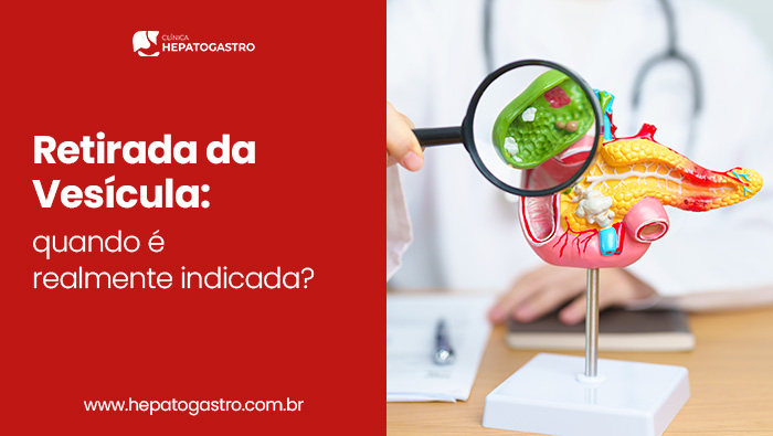 Retirada Da Vesícula: Quando É Realmente Indicada? 1 Profissional Aponta Lupa Para Modelo Anatômico Da Vesícula E Pâncreas Durante Explicação Médica.