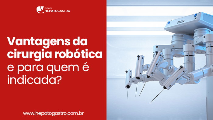 Vantagens Da Cirurgia Robótica E Para Quem É Indicada? 1 Sistema Robótico Cirúrgico Com Braços Articulados E Instrumentos De Alta Precisão, Representando Cirurgia Robótica Minimamente Invasiva.