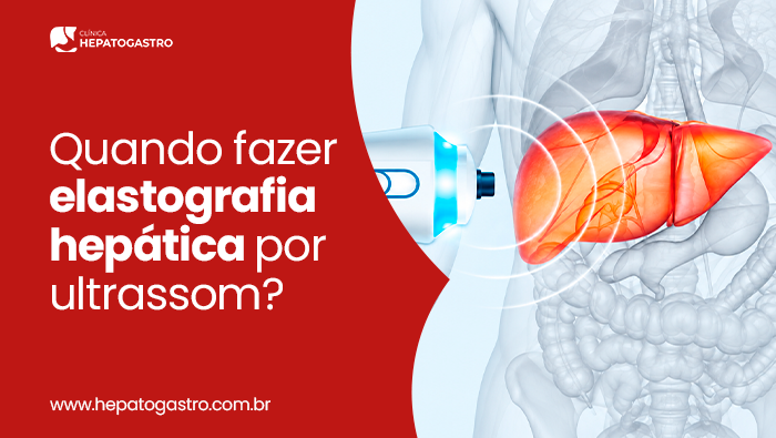Quando Fazer Elastografia Hepática Por Ultrassom? 1 Arte Sobre Elastografia Hepática Por Ultrassom