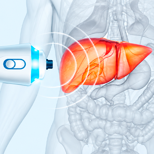 Ilustração médica de elastografia hepática por ultrassom