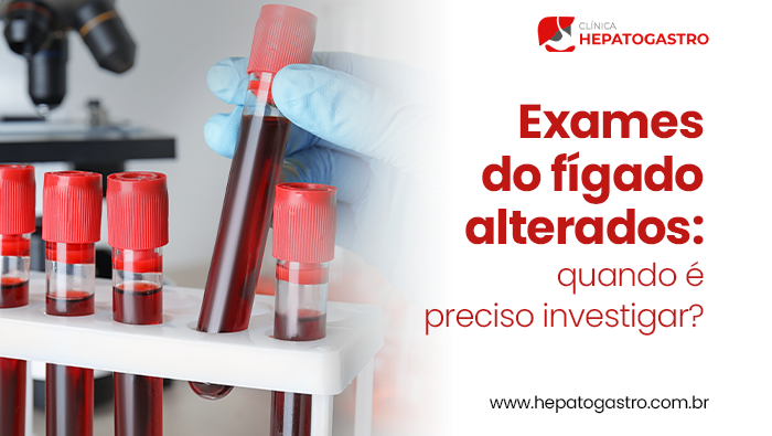 Exames Do Fígado Alterados: Quando É Preciso Investigar? 1 Arte Sobre Exames Do Fígado Alterados