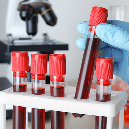 Tubos de sangue para exames laboratoriais do fígado